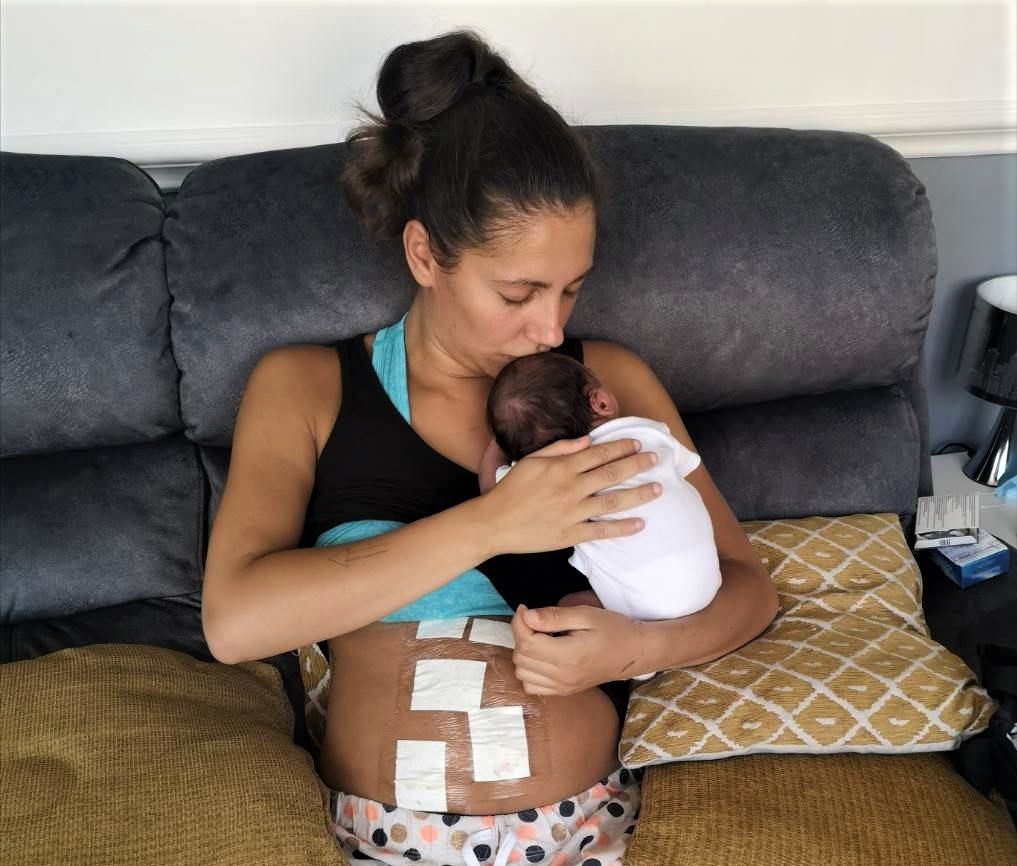 Rachel with her baby after surgery